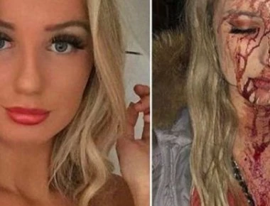 Και την «χούφτωσε» και της έσπασε το κεφάλι επειδή αντέδρασε